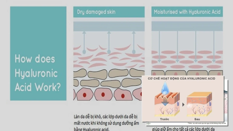 Axit Hyaluronic: Cơ Chế Hoạt Động Dưỡng Ẩm Da Chuyên Sâu